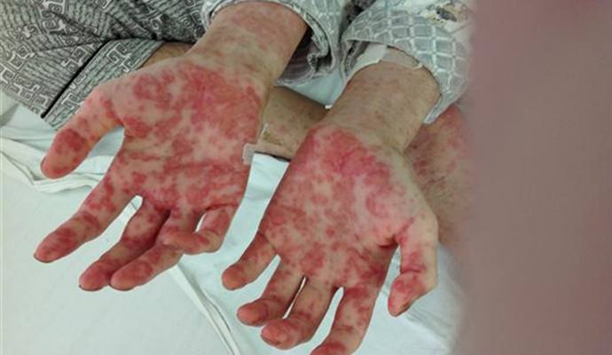 室內(nèi)甲醛檢測治理，你不得不需要了解的三點！