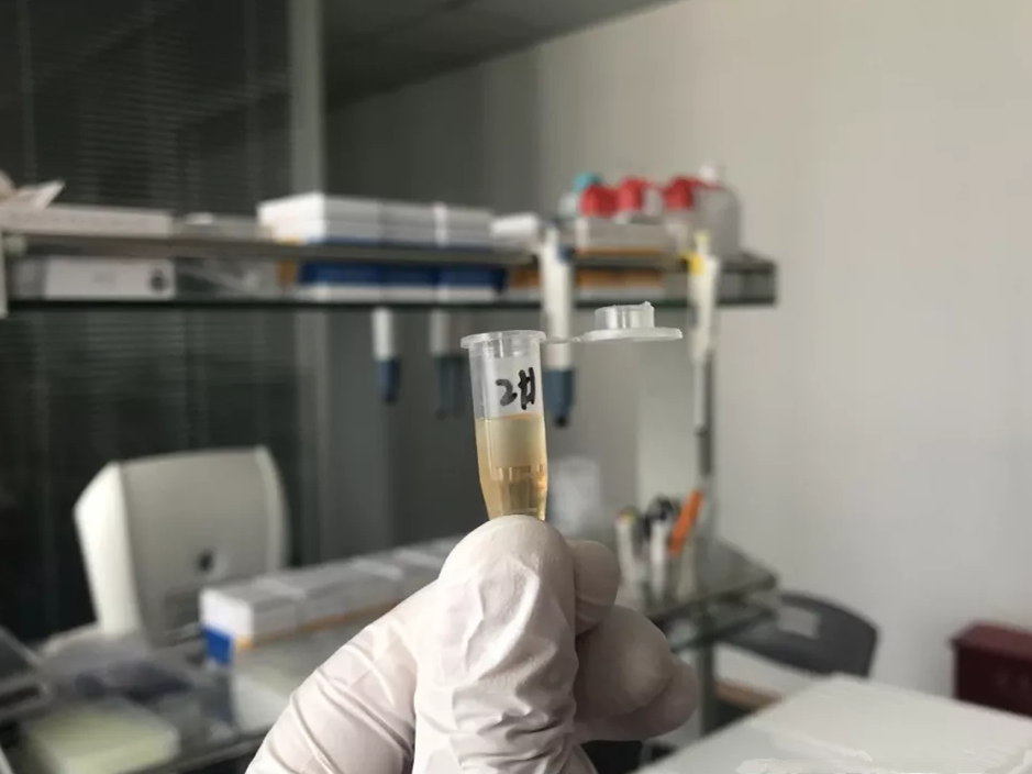 水煮花生含甲醛？實(shí)測多家燒烤店結(jié)果太可怕！